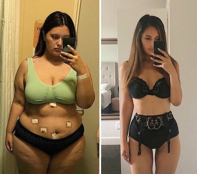 Girls before and after weight loss with capsules KETO Complete